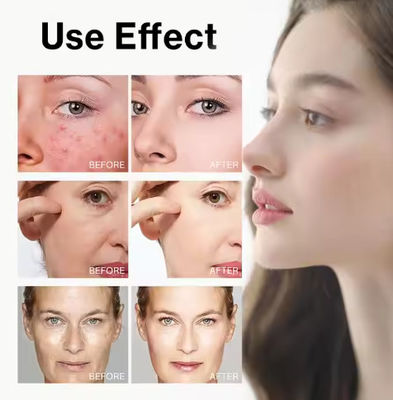 Hot Selling 7% Glycolic Acid Exfoliating Toner Acne Removal Face Skin Care Toner Private Label Glycolic Exfoliating Toner