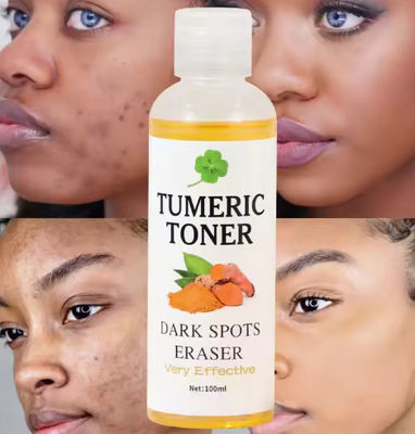 Private Label Face Toner Moisturizing Spray Deep Face Hydrating Quickly Absorb VC Whitening Skin Moisturizing Face Spray