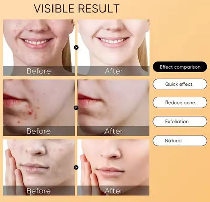 Hyaluronic Toner Rice Water Rose Moisture Tonic Oil Control Hydrating Facial Toner