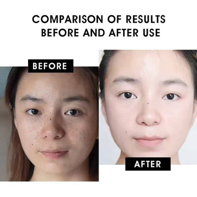 Skincare Face Serum Hydrating Vitamin C Serum Wrinkle Firming Skin OEM ODM