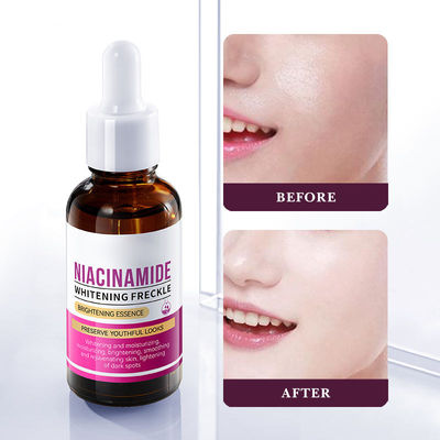 ODM OEM  Beauty Essence Liquid Moisturizing Serum Nicotinamide Remove Freckle Whitening