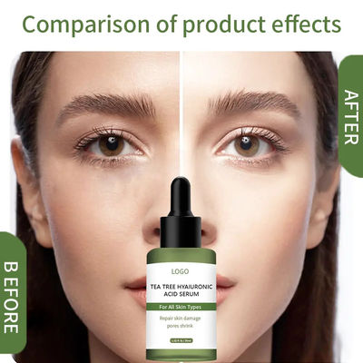 Tea Tree Sensitive Skin Glow Facial Serum Hyaluronic Acid Serum For Face Whitening