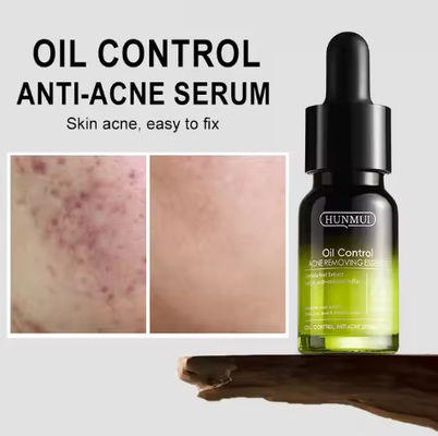 Customized Logo Face Serum OEM ODM Cosmetics 14 Day Quick Acne Solution Essence