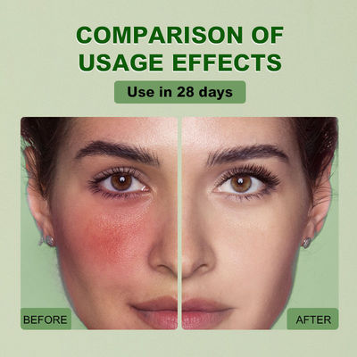 Anti Wrinkle Moisturizing Collagen OEM Cosmetic Manufacturer Whitening Facial Serum