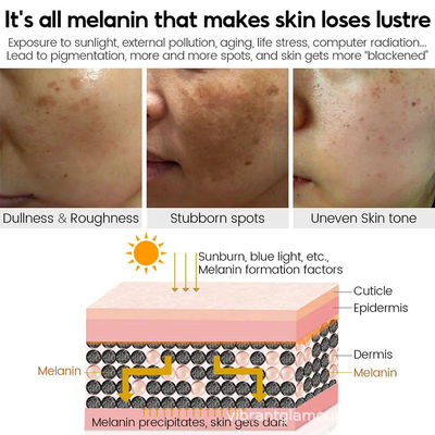 Face Cream Whitening Moisturizer Anti Aging Acne Vitamin C Black Spot Remover Cream