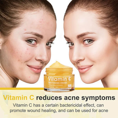 Face Cream Whitening Moisturizer Anti Aging Acne Vitamin C Black Spot Remover Cream