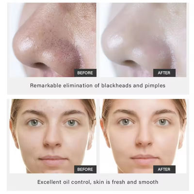 OEM ODM Mud Mask Facial Care Blackheads Acne Gently Clean Pore Volcanic Mud Bamboo Charcoal Kaolin Clay Face Mask