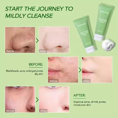 Facial Cleanser For Men And Women Deep Cleansing Shrinking Pores Moisturizing