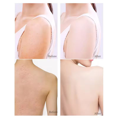 Natural Organic Oat Niacinamide Body Scrub Exfoliating Anti Aging Cellulite Dead Scrub