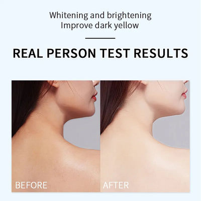 Bodycare Whitening Body Lotion Remove Black Spots And Dark Yellow Skin Care
