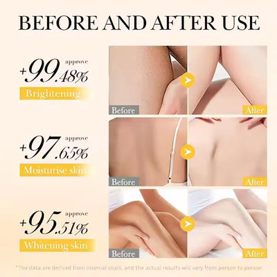 Turmeric VC Whitening OEM Body Lotion Anti Acne Hydrating Customized Logo