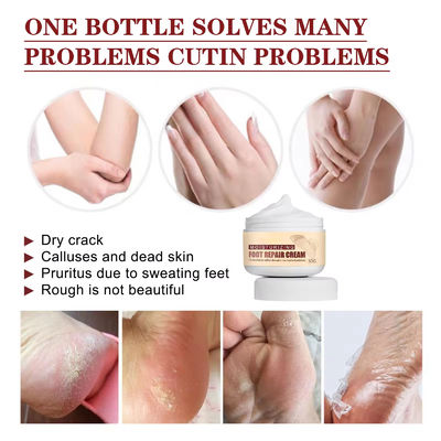 OEM ODM Hand And Foot Care Cream Anti Cracking Dry Peeling Repairing Cracks