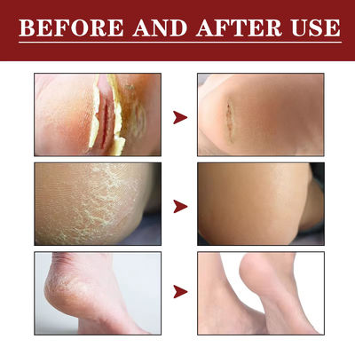 OEM ODM Hand And Foot Care Cream Anti Cracking Dry Peeling Repairing Cracks