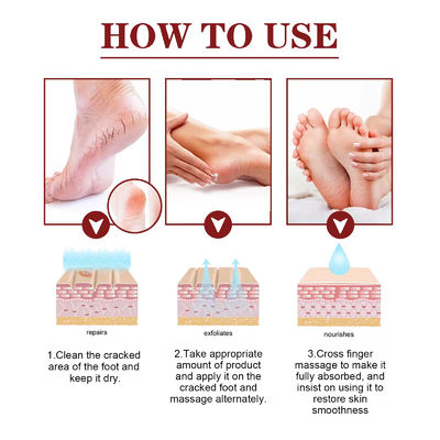 OEM ODM Hand And Foot Care Cream Anti Cracking Dry Peeling Repairing Cracks